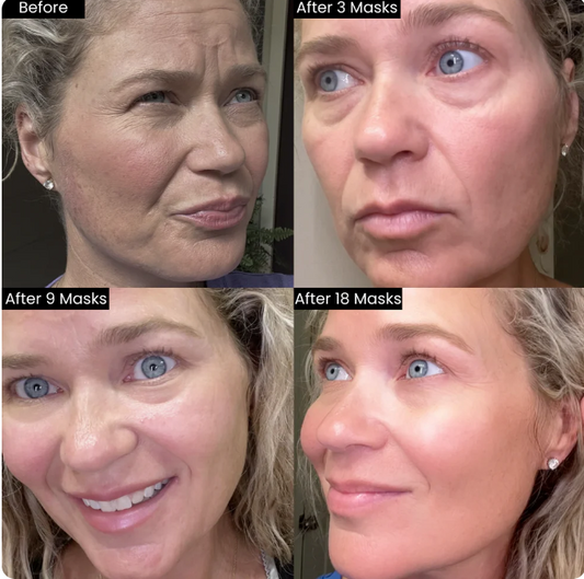 Lunaraa Mascarilla facial de hidrogel