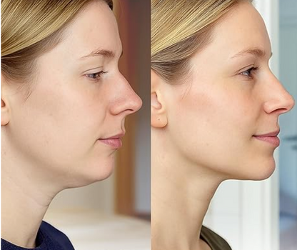 Lunaraa®  Neck Mask