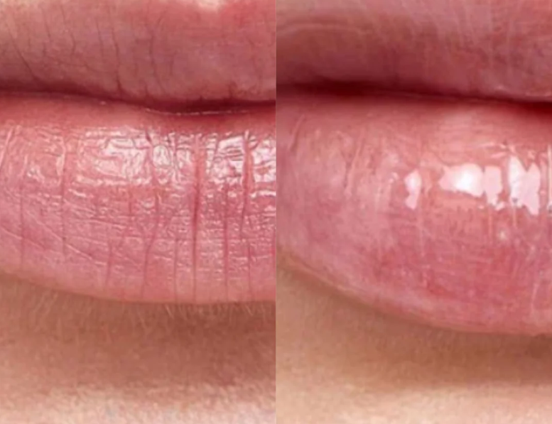 Lunaraa Hidratación Intensiva para labios – Rejuvenecedora y Antiarrugas