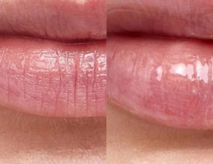 Lunaraa Hidratación Intensiva para labios – Rejuvenecedora y Antiarrugas