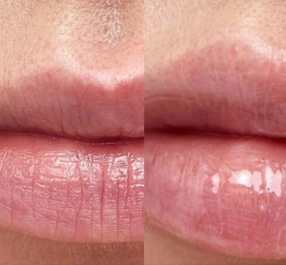 Lunaraa Hidratación Intensiva para labios – Rejuvenecedora y Antiarrugas
